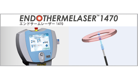 血管内レーザー焼灼術に使用するレーザーファイバー